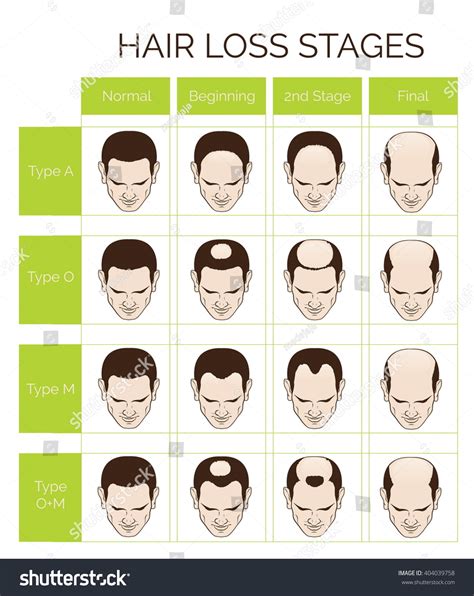 hair baldness types